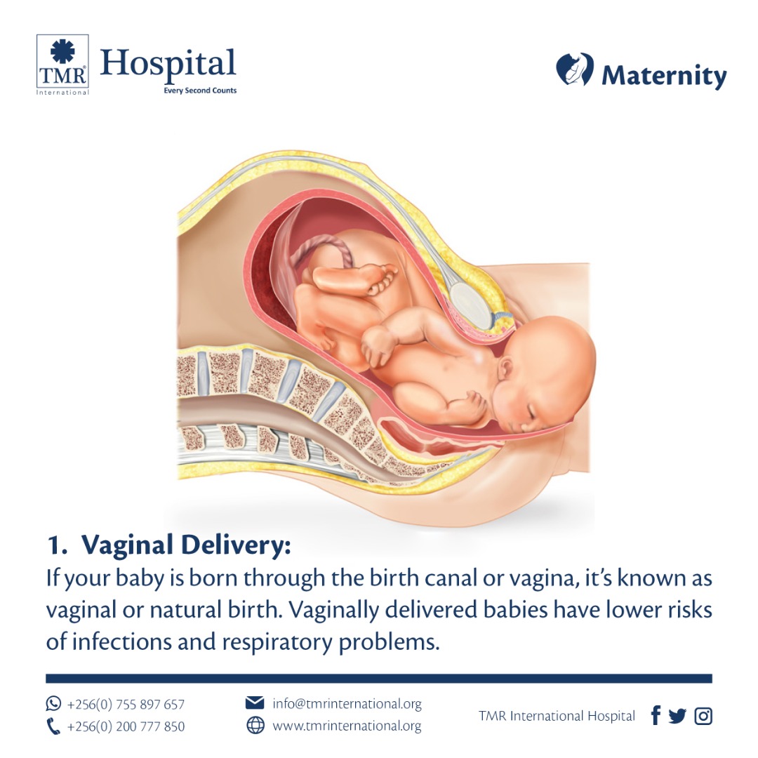 Child birth vaginal delivery
